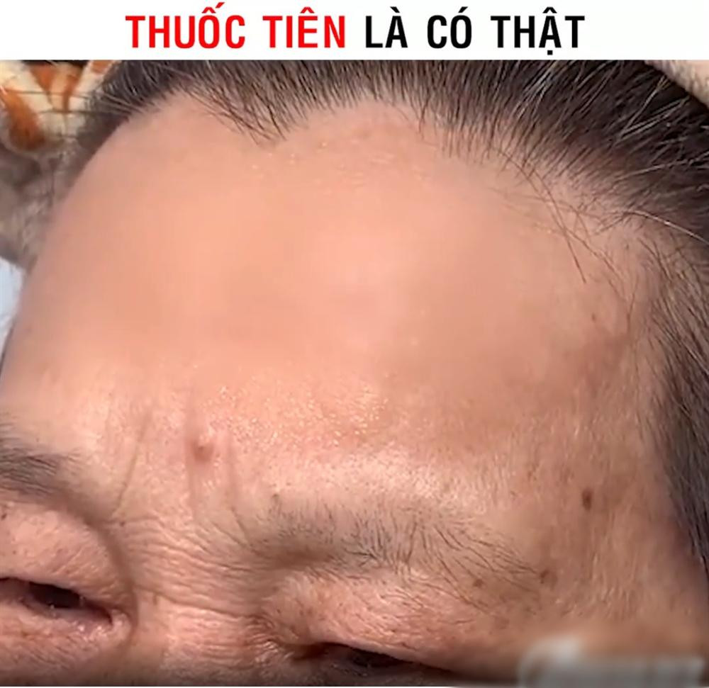 au khi thoa chỉ trong chưa đầy 1 phút, phần trán mịn màng như da em bé.