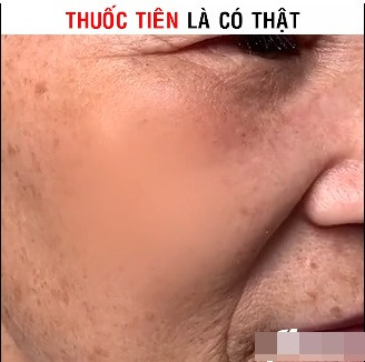 Thậm chí, nói rằng nó giúp "cải lão hoàn đồng" cũng không ngoa!