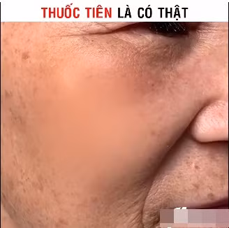 Thậm chí, nói rằng nó giúp "cải lão hoàn đồng" cũng không ngoa!