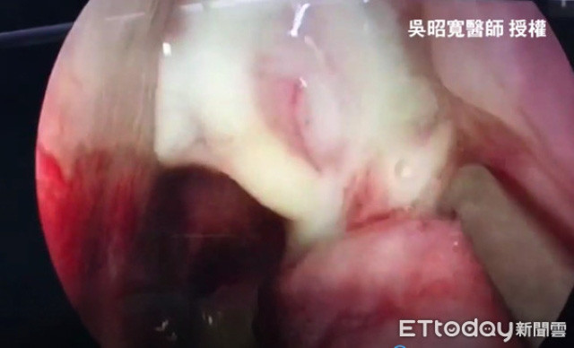 Sau khi hon, chang trai bat ngo non oi vi thu khung khiep-Hinh-2