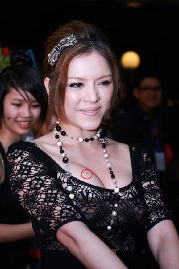 Au Ha My bi boc lam gia not ruoi phu quy o nguc-Hinh-3