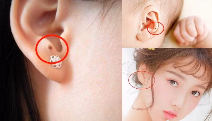 Nốt ruồi ở vị trí này quý như kim cương, có được là lộc Not ruoi o vi tri nay quy nhu kim cuong, co duoc la loc