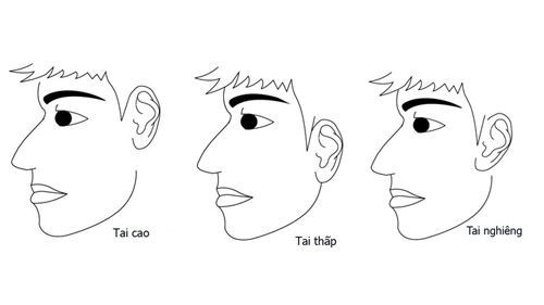 Tướng tai của người phụ nữ giàu sang, là phúc tinh của gia đình Tuong tai cua nguoi phu nu giau sang, la phuc tinh cua gia dinh