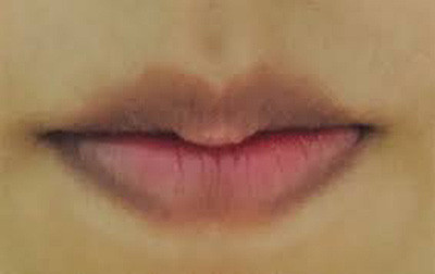 3 vị trí trên cơ thể tố cáo phổi xấu hay tốt - Hình 2 3 vi tri tren co the to cao phoi xau hay tot-Hinh-2