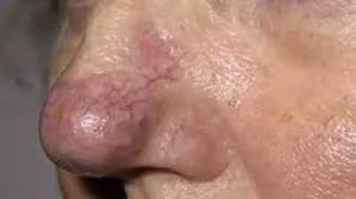 3 vị trí trên cơ thể tố cáo phổi xấu hay tốt - Hình 3 3 vi tri tren co the to cao phoi xau hay tot-Hinh-3