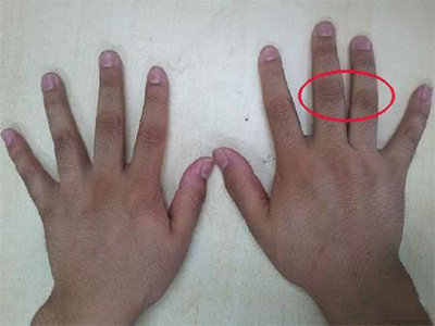 3 vị trí trên cơ thể tố cáo phổi xấu hay tốt 3 vi tri tren co the to cao phoi xau hay tot