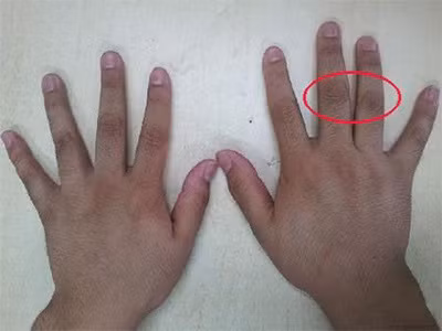 3 vị trí trên cơ thể tố cáo phổi xấu hay tốt 3 vi tri tren co the to cao phoi xau hay tot