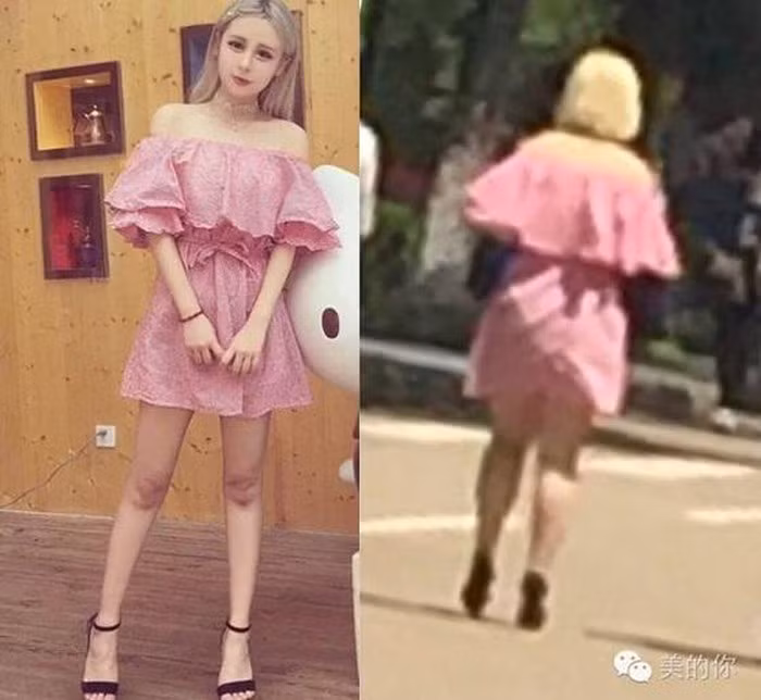 Trong những bức ảnh do người qua đường vô tình ghi lại được, Shirley gây thất vọng vì vẻ ngoài kém sắc. Đôi chân dài miên man từng khiến nhiều người ngưỡng mộ của Shirley hóa ra cũng chỉ là sản phẩm của photoshop và app chỉnh ảnh. Những bức ảnh đời thật đã "tố cáo" nhiều khuyết điểm về ngoại hình, đồng thời bóc phốt hot girl sống ảo, lạm dụng phần mềm chỉnh sửa. Vỡ mộng vì hình ảnh đời thực kém sắc của Shirley, nhiều dân mạng đã ngay lập tức bỏ follow cô nàng, quay lưng chỉ trích hot girl lừa dối người hâm mộ. Sau vụ việc, Vu Văn Tĩnh tỏ ra bức xúc vì những bình luận chê bai từ cộng đồng mạng. Cô giải thích mình chỉ hơi béo và loạt ảnh bóc phốt trên mạng là do người đăng cố tình làm xấu. Do ứng dụng làm đẹp ngày càng phổ biến và đa dạng, không ai gặp khó khăn trong việc chỉnh sửa các đặc điểm trên gương mặt họ cho tới khi cảm thấy hoàn hảo. Và khi con người dồn tất cả nỗ lực chỉ để đẹp hơn trong mắt người khác, họ hoàn toàn quên đi vẻ đẹp thực sự của bản thân. Không chỉ Shirley, hàng loạt hot girl khác cũng từng bị bóc phốt chỉnh ảnh quá đà, lừa dối người hâm mộ.