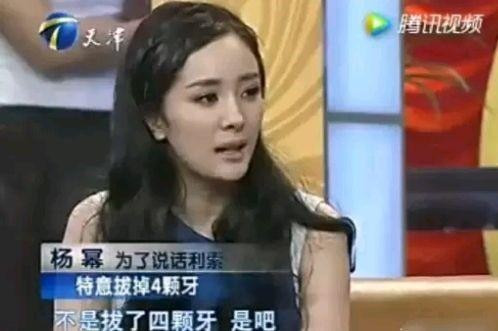 Duong Mich: Sot den 39 do van lam viec, vi dong phim da nho 4 cai rang-Hinh-13