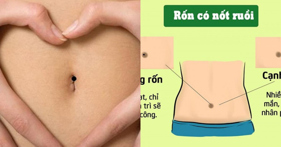 Phu nu so huu not ruoi vung ron quy nhu kim cuong “hut vang”