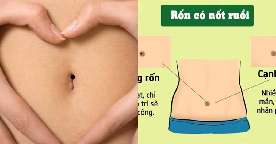 Phu nu so huu not ruoi vung ron quy nhu kim cuong “hut vang”