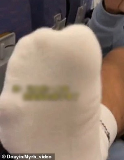 Bi nhac nho, hanh khach di chan vao mui nguoi nhac-Hinh-3