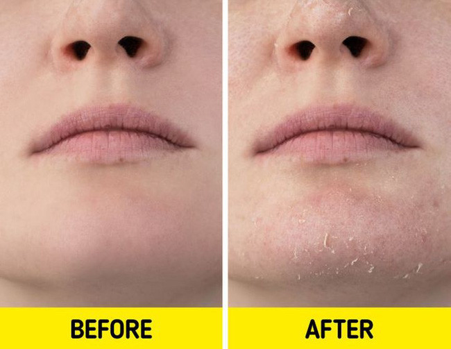 Bạn sẽ phải lãnh ngay hậu quả này nếu măc quá ấm khi đi ngủ - Hình 3 Ban se phai lanh ngay hau qua nay neu mac qua am khi di ngu-Hinh-3