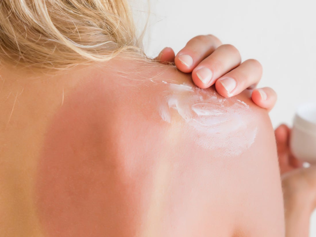 Bi mun nuoc do chay nang, nhieu nguoi xu ly rat sai-Hinh-3