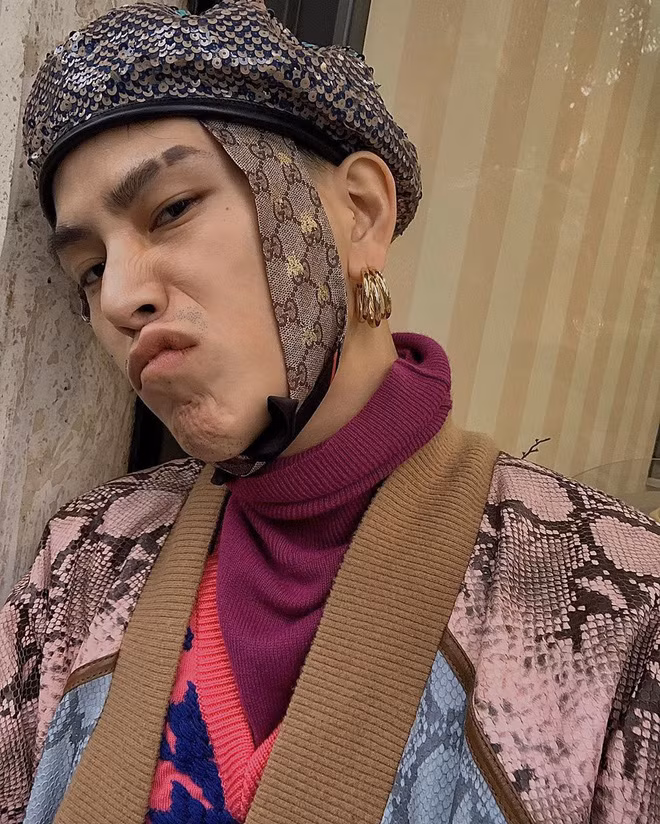 Decao khoi xuong mau mong tay rang cua tu ve gay tranh cai