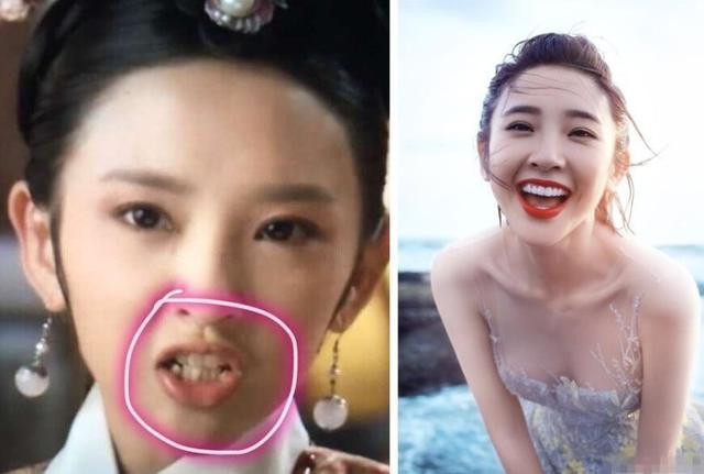 Những hàm răng khấp khểnh kém duyên của sao Hoa ngữ - Hình 3 Nhung ham rang khap khenh kem duyen cua sao Hoa ngu-Hinh-3