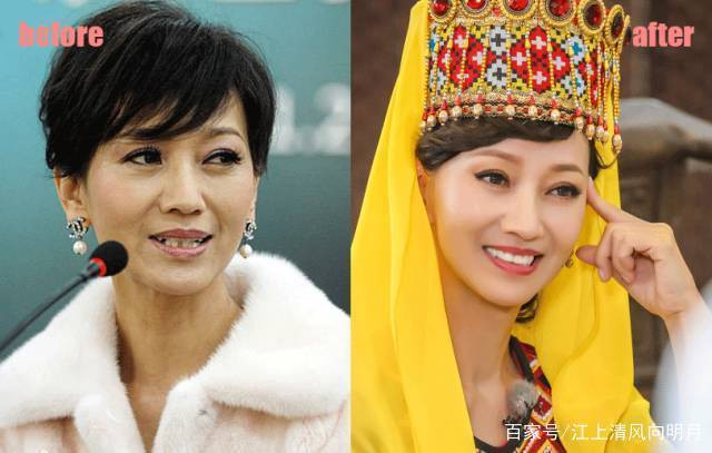 Những hàm răng khấp khểnh kém duyên của sao Hoa ngữ - Hình 6 Nhung ham rang khap khenh kem duyen cua sao Hoa ngu-Hinh-6