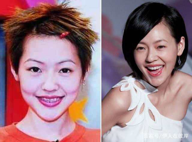 Những hàm răng khấp khểnh kém duyên của sao Hoa ngữ - Hình 4 Nhung ham rang khap khenh kem duyen cua sao Hoa ngu-Hinh-4