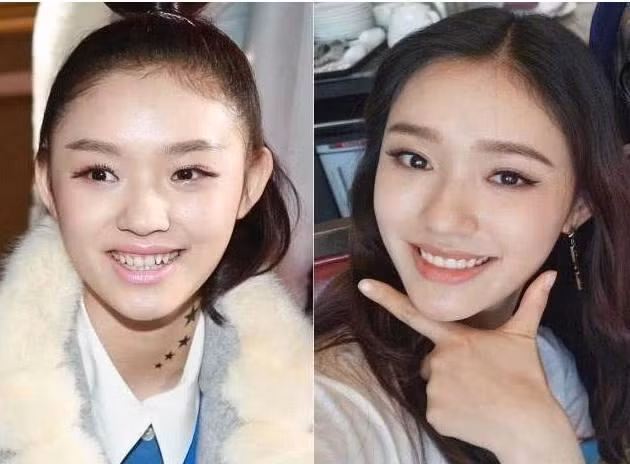 Nhung ham rang khap khenh kem duyen cua sao Hoa ngu-Hinh-5