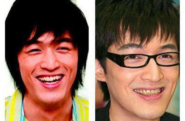 Những hàm răng khấp khểnh kém duyên của sao Hoa ngữ - Hình 8 Nhung ham rang khap khenh kem duyen cua sao Hoa ngu-Hinh-8