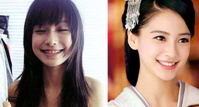 Những hàm răng khấp khểnh kém duyên của sao Hoa ngữ - Hình 2 Nhung ham rang khap khenh kem duyen cua sao Hoa ngu-Hinh-2