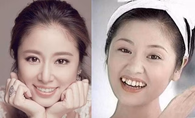 Nhung ham rang khap khenh kem duyen cua sao Hoa ngu