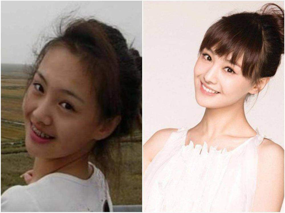 Những hàm răng khấp khểnh kém duyên của sao Hoa ngữ - Hình 12 Nhung ham rang khap khenh kem duyen cua sao Hoa ngu-Hinh-12