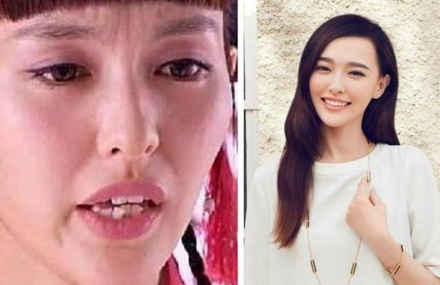 Những hàm răng khấp khểnh kém duyên của sao Hoa ngữ - Hình 7 Nhung ham rang khap khenh kem duyen cua sao Hoa ngu-Hinh-7