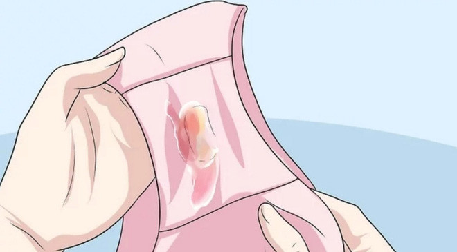 Kinh nguyet bat thuong ngam canh bao nguy co khung khiep nay-Hinh-3