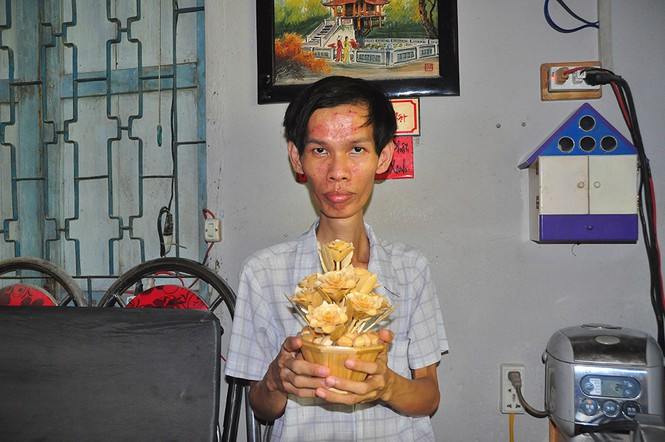 Tac pham nghe thuat tu tre cua chang trai khuyet tat-Hinh-2