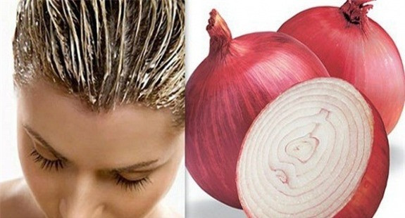 Mẹo hay: "Tạm biệt" tóc rụng, hói đầu chỉ bằng 1 củ hành tây ảnh 1