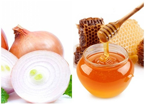 Mẹo hay: "Tạm biệt" tóc rụng, hói đầu chỉ bằng 1 củ hành tây ảnh 2