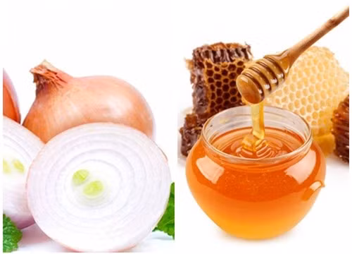 Mẹo hay: "Tạm biệt" tóc rụng, hói đầu chỉ bằng 1 củ hành tây ảnh 2