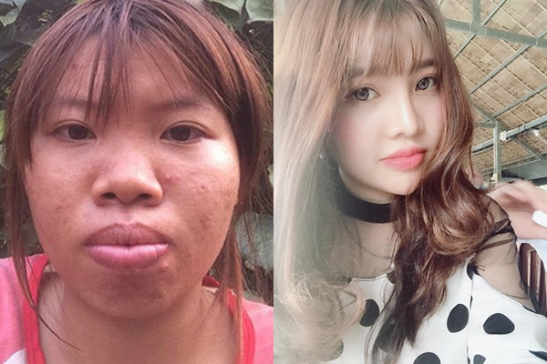 'Thi No' Quach Phuong 'giat minh' vi su thay doi cua ban than