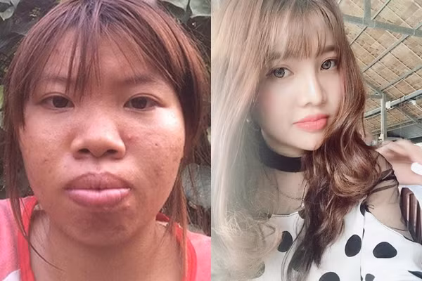 'Thi No' Quach Phuong 'giat minh' vi su thay doi cua ban than