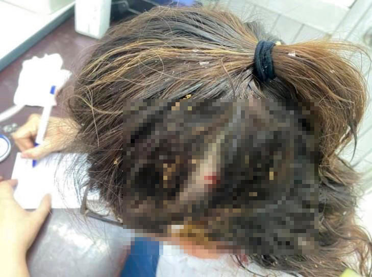 Thanh nien hanh hung co gai vi xin so tan tinh khong duoc-Hinh-2