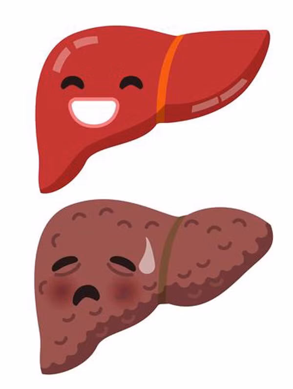 Dau hieu tren tay canh bao som ung thu gan