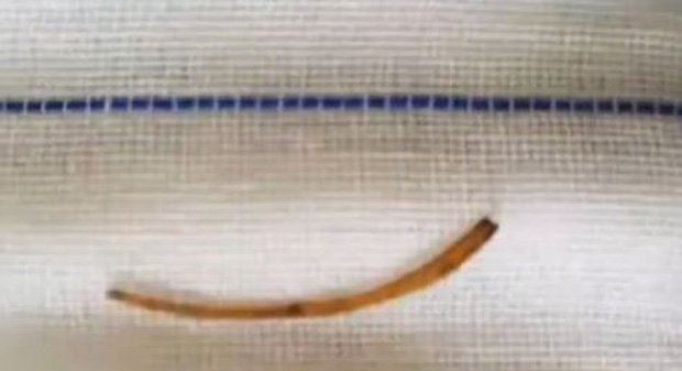 Nguoi dan ong di kham moi phat hien xuong ca mac o hau mon-Hinh-2