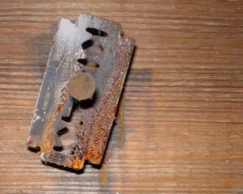 Nhung man ao thuat 'den dui' va chet choc trong lich su