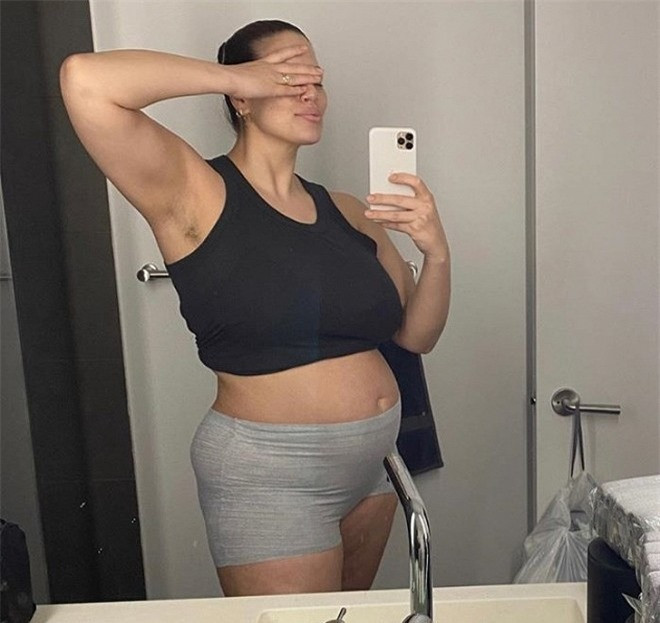 Tại sao ngày càng nhiều phụ nữ ngừng việc cạo lông trên cơ thể? ảnh 5