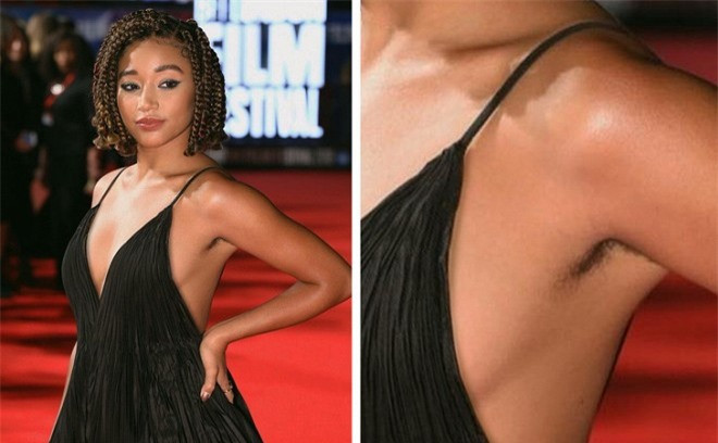 Tại sao ngày càng nhiều phụ nữ ngừng việc cạo lông trên cơ thể? ảnh 2