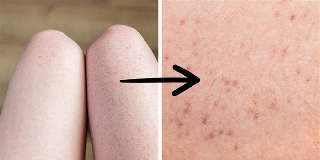 Tại sao ngày càng nhiều phụ nữ ngừng việc cạo lông trên cơ thể? ảnh 4