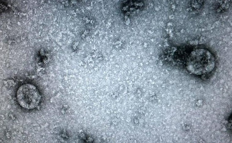 UNICEF chia se 'Vu dieu rua tay' phong virus corona cua Quang Dang-Hinh-6