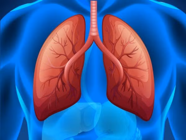 10 bien chung nguy hiem cua benh COVID-19