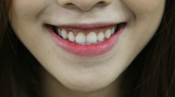 Nhan dien tuong dan ba hay ghen tuong mu quang