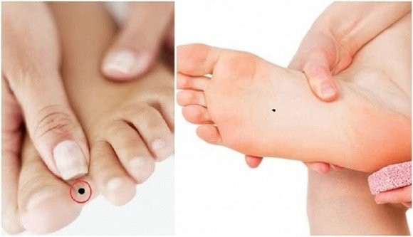 Sở hữu 3 nốt ruồi ở vị trí này cuộc sống cực kỳ giàu sang - Hình 2 So huu 3 not ruoi o vi tri nay cuoc song cuc ky giau sang-Hinh-2