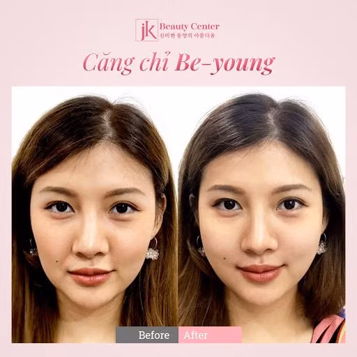 Cong nghe cang chi Be-Young duoc phu nu Viet san don-Hinh-2