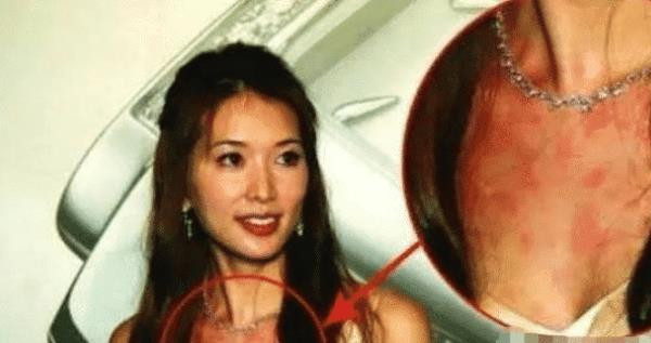 Nhung sao Hoa mat hinh tuong khi say ruou