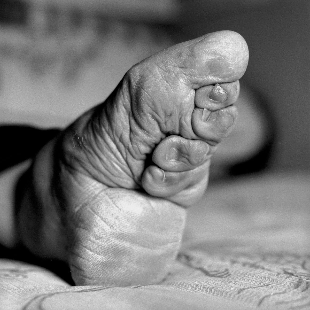 Người mẹ hoặc người bà trong gia đình sẽ bắt đầu bó chân con gái hoặc cháu gái khi đứa trẻ từ 2 đến 5 tuổi. Họ cho biết việc bó sẽ dễ dàng hơn khi khung xương chân của các bé gái chưa phát triển toàn diện. Quá trình thực hiện thường bắt đầu vào mùa đông khi chân trẻ tê lạnh để chúng đỡ đau đớn hơn.