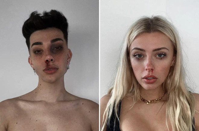 Trào lưu này xuất phát từ một số clip "biến hình" đăng tải trên ứng dụng video TikTok, khi người tham gia cố tình trang điểm bản thân như đang bị thương. Sau khi được nhiều influencer, blogger nổi tiếng như James Charles, Corinna Kopf và Avani Gregg hưởng ứng, trào lưu này mới được nhiều bạn trẻ biết tới, đặc biệt ở các nước phương Tây.